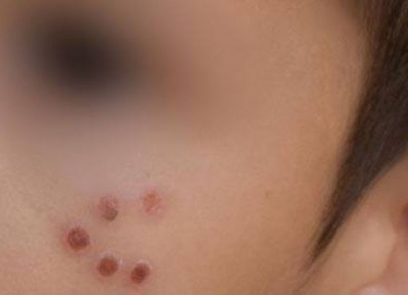 Capital: disponen la prisión preventiva para un hombre acusado de golpear y quemar con cigarrillo al hijo de su pareja