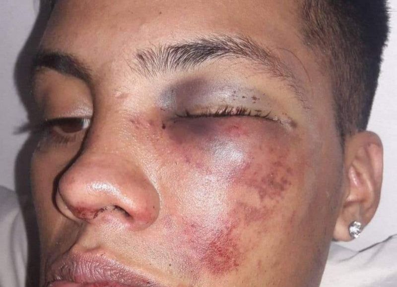 Esperanza: un joven fue al boliche y recibió una golpiza