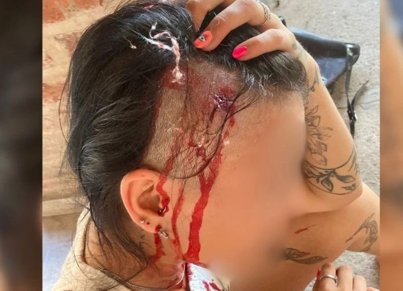 Capital: asaltaron brutalmente a una mujer en el barrio Barranquitas