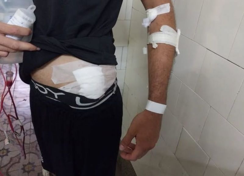 Dos violentos robos de motos en 24 horas: un joven recibió dos disparos de arma de fuego